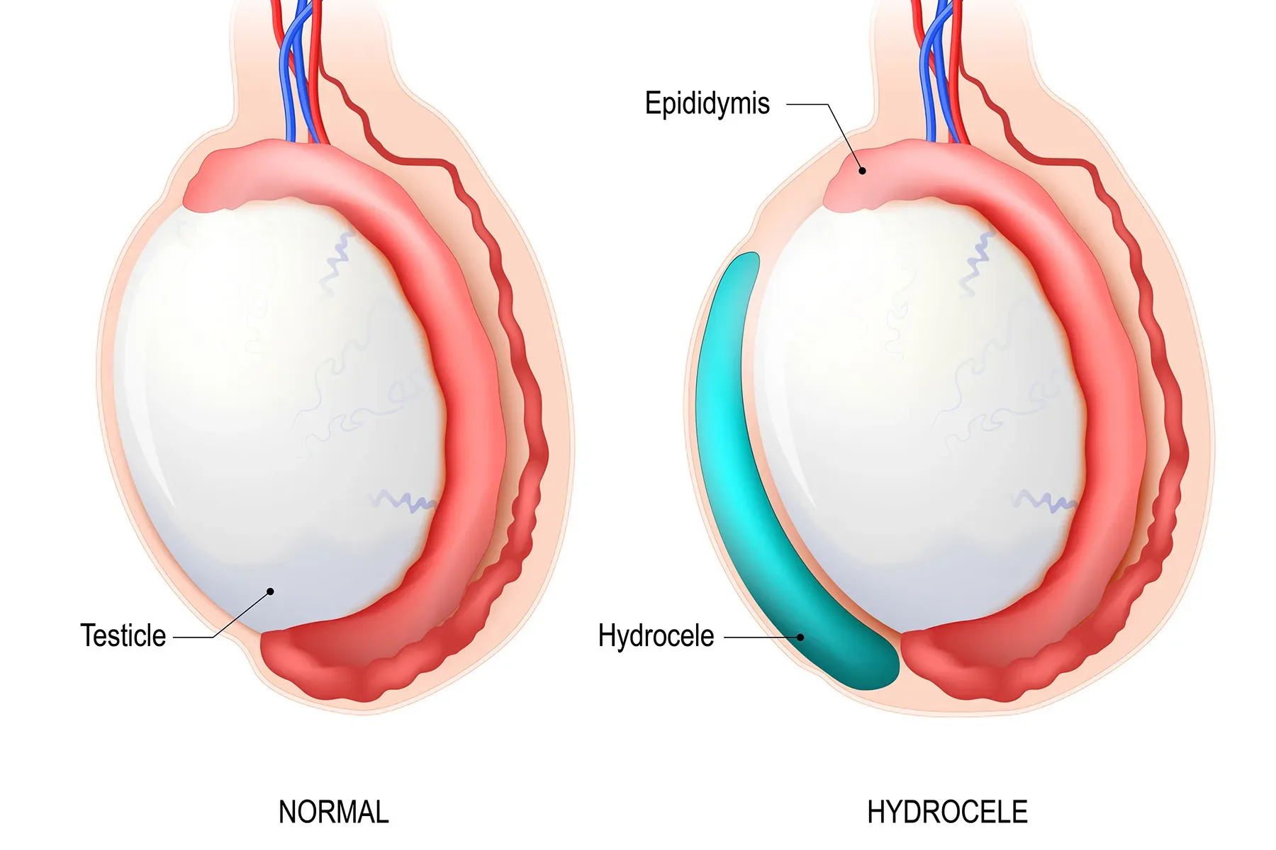 Buzuqlik va pornografiya