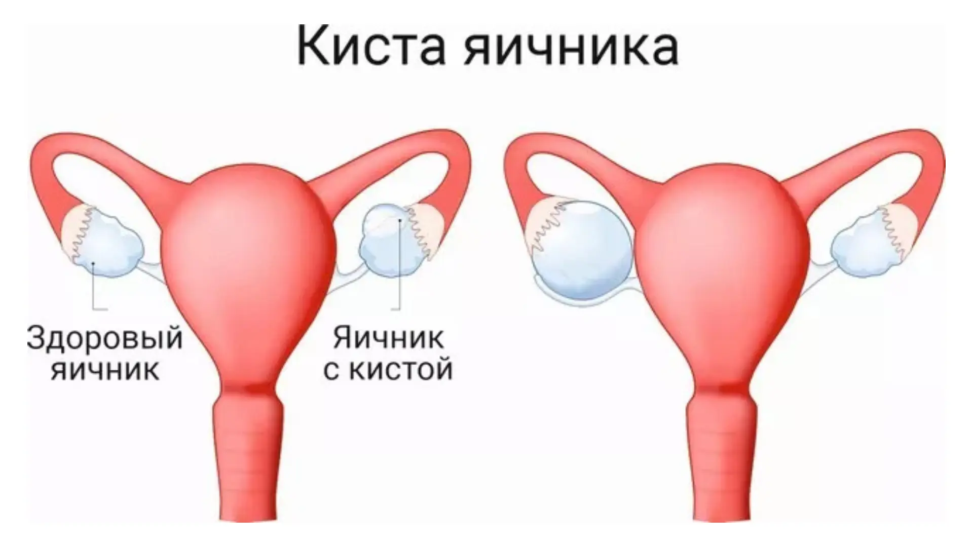 Skyrim pubik soch jinsiy aloqa mod